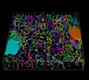 3D reconstruction of hepatic stellate cells